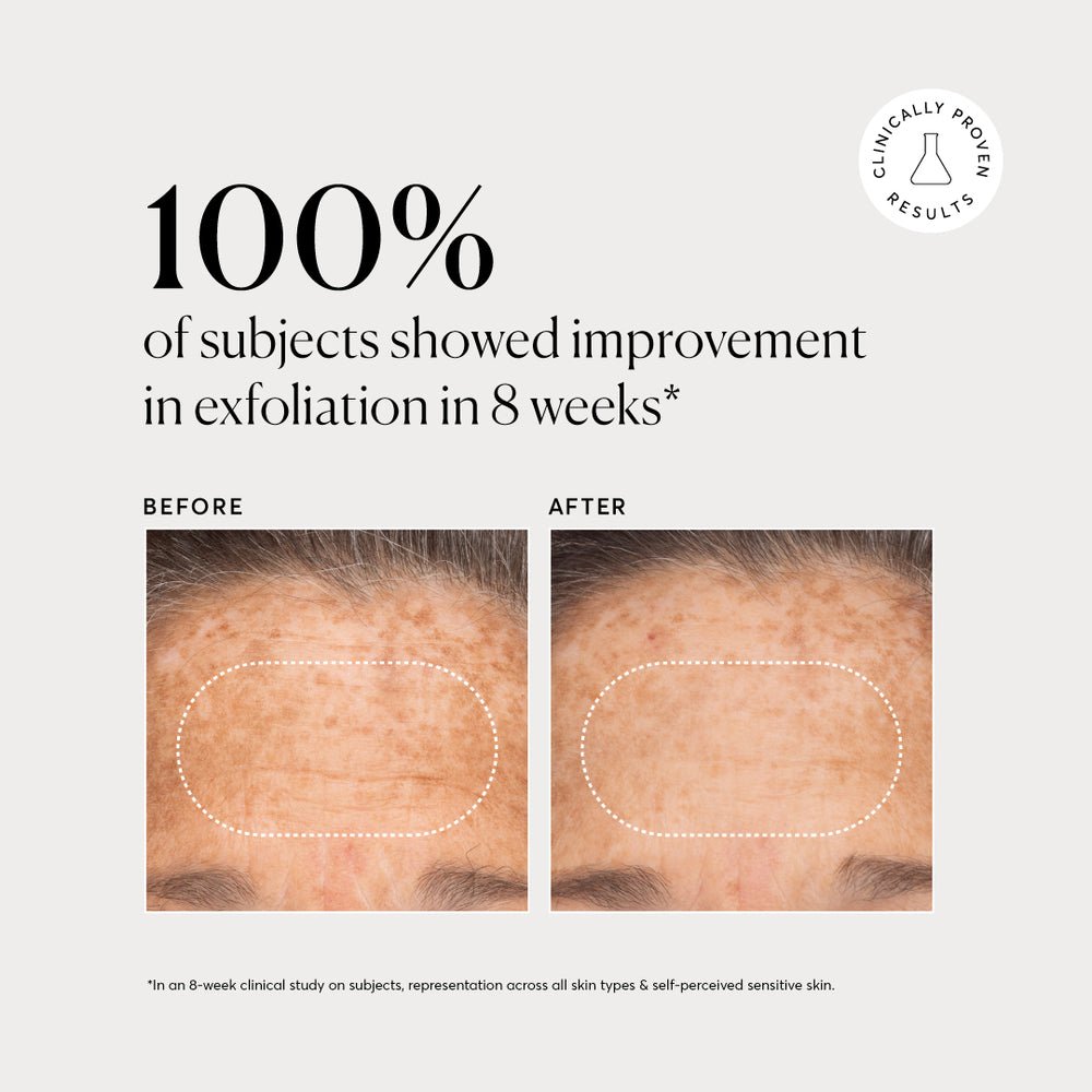 Naturium BHA Liquid Exfoliant 2% -120mL - Image 4