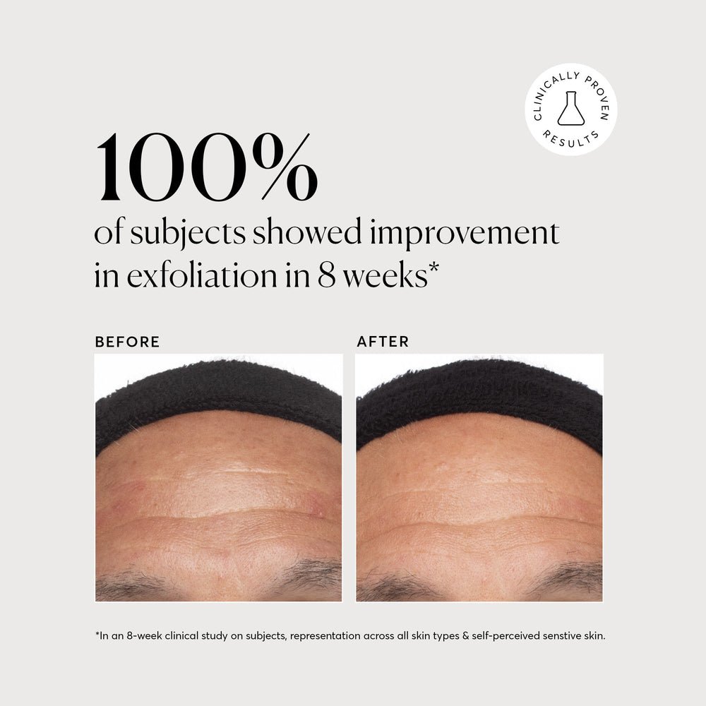 Naturium Azelaic Topical Acid 10% - 30ml - Image 4